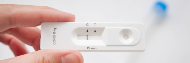 Farmacias y usuarios, a la espera del boe para iniciar la libre dispensación de test Covid-19